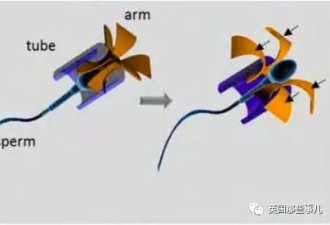 用精子送快递，把药物直捣女性癌症患者体内?