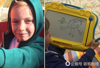 7岁男孩被医生漏诊 自己画出脑部囊肿