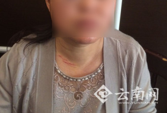 昆明一女司机停车堵了出口 挪车时遭6人围殴