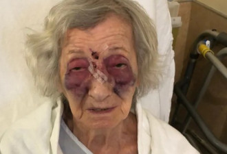 92岁老妇乘公交被打:智障打人者不会被诉