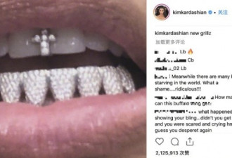 金卡戴珊再晒钻石牙套 有钱人的世界真难懂！