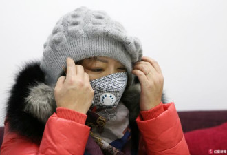 女子连吃火锅头部肿变形 竟因20年前打美容针？