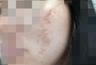 江西商场办化妆活动 多名女大学生惨遭毁容