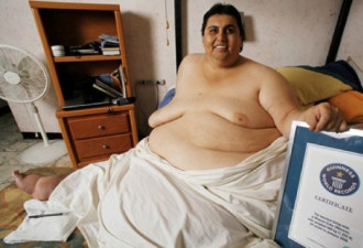 597公斤的世界最重男子“缩胃”手术成功