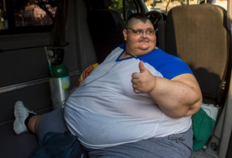 597公斤的世界最重男子“缩胃”手术成功
