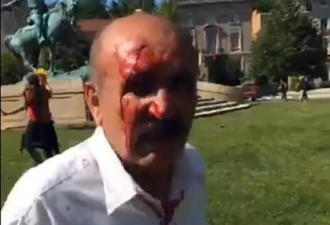 土耳其驻美大使馆外抗议溅血 9伤2人被捕