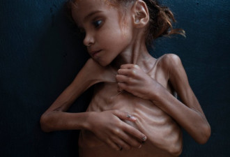 也门一处粮仓惨遭焚毁，损失370万人1月口粮