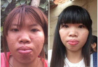 女子自卑20年 整容后大变脸 成越南网红