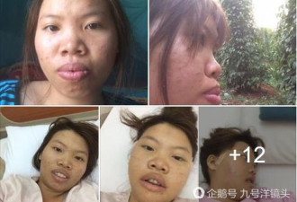 女子自卑20年 整容后大变脸 成越南网红