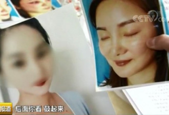 会缝衣服就会做双眼皮？培训三天可出师…