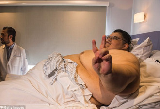 世界上最胖的男子出院:第一次感到呼吸顺畅