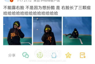 宋祖儿脸上长痘到不能露脸？她该跟欧阳娜娜学