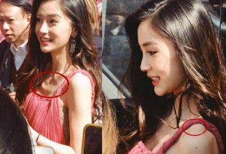 Angelababy未修图曝光，肋骨突出瘦到吓人