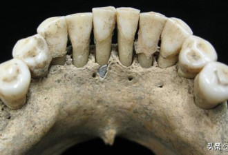 1000年前的牙垢里考古学家发现贵比黄金的东西
