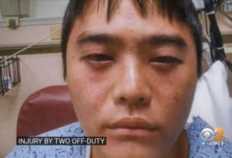 华裔学生被消防员暴力围殴 获赔$740万