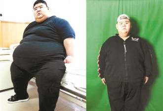 中国“第一胖”半年多长高2厘米 减重284斤