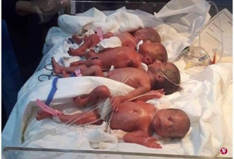 伊拉克一名25岁女子顺利产下七胞胎 系该国首例