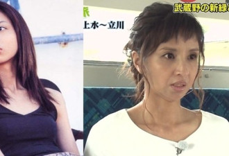 整容后遗症!日本43岁女星垮脸老态惊呆网友