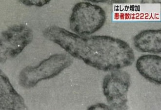 赴日旅游小心！日本麻疹疫情蔓延222人确诊