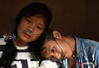 中国人的一天:他们外出淘金，却全家患上尘肺病