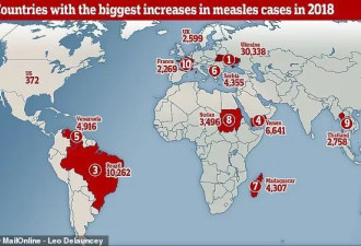 世界麻疹大爆发 联合国警告称这些地区成重灾区