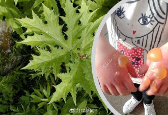慎入剧毒植物英国疯长蔓延人体碰一下会成这样