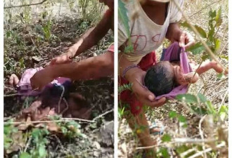 新生女婴被弃草丛 浑身被蚊虫叮咬面部晒出水泡