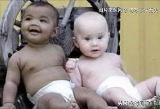 厦门一对双胞胎竟是同母异父 概率为百万分之一