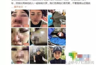 丽江被打毁容女近照曝光：纵使万般无奈又怎样