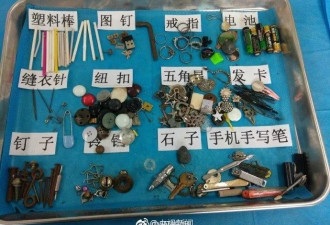 孩子吞下过的物件：图钉电池硬币磁铁啥都有