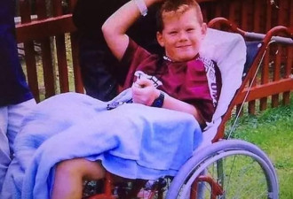 截肢男模成英国先生 自幼坐轮椅 16岁锯掉右腿