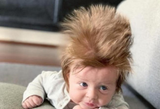 澳洲4月大男婴因天生“怒发冲冠”成最小网红