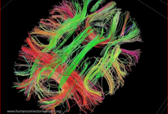 新量子材料问世 未来从云端“下载大脑”