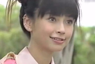 Baby14岁照片被扒出， 一嘴烂牙像玻璃渣子...