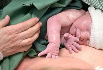 由机械臂协助移植子宫 瑞典女成功诞下宝宝