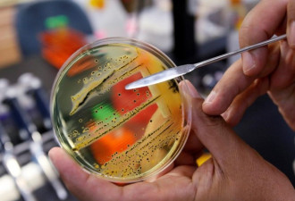 加拿大六省爆发沙门氏菌感染 68人生病18人入院