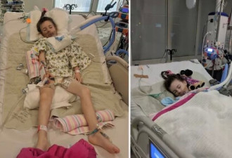 澳洲5岁女童重病半年时间，生命垂危！