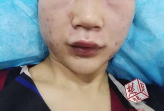 女游客称在昆明遭陌生男追打 满脸是血被缝6针