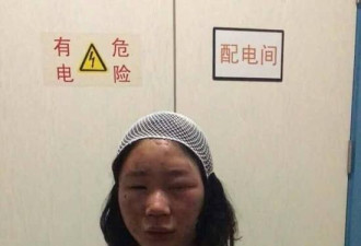 女游客称在昆明遭陌生男追打 满脸是血被缝6针