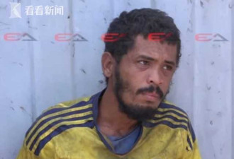 国外男子染毒瘾后患蝇蛆病 遭4000只寄生虫啃脑