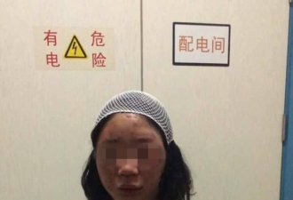 女大学生昆明旅游被打一身血:不知为啥被打