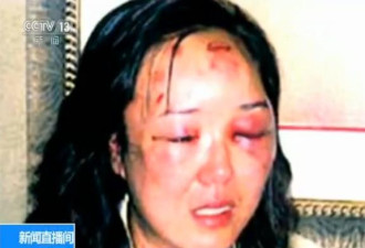 中国女子旅美遭警察暴打13年后获赔 当事人上诉