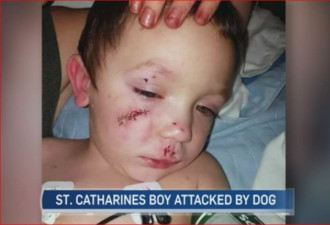 两个男孩被狗严重咬伤：这个小城怎么了