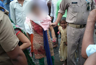 印度男子求爱不成 闹市中砍断15岁少女左手