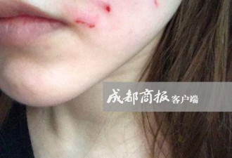 女主播遛狗未拴绳遭暴打 道歉:对不起吓到孩子