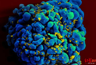 艾滋或终结？新疗法可阻止HIV携带者传播病毒