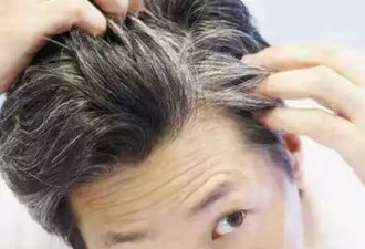 早早长白头发不是未老先衰 而是为了对抗痴呆？
