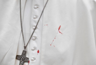 教宗脸部撞伤 左眼瘀青 血溅白色披风