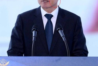 韩总统脸淤青疑似受伤：没什么 就拔了10颗牙