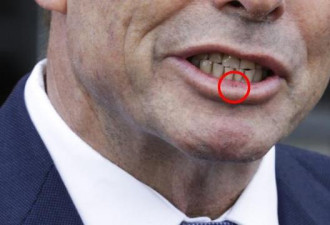 澳前总理参加反同性婚姻活动 遭“铁头功”顶伤